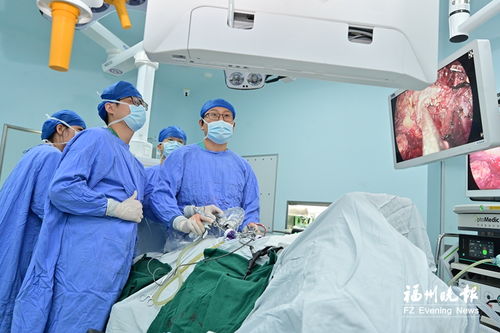 福州市第一总医院泌尿微创与转化医学中心直播6台高难度手术
