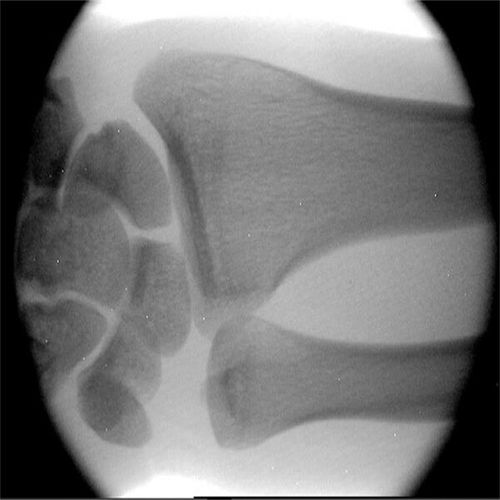 便携医疗新篇章 医用便携式X光机在中医正骨与下乡出诊中的革命性应用
